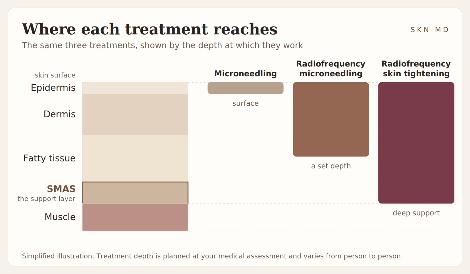 Diagram comparing the depth at which microneedling, radiofrequency microneedling and radiofrequency skin tightening work, from the epidermis down to the SMAS support layer