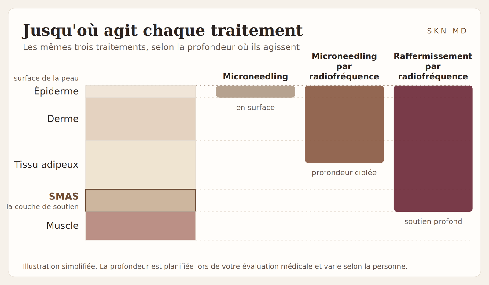 Schéma comparant la profondeur à laquelle agissent le microneedling, le microneedling par radiofréquence et le raffermissement par radiofréquence, de l'épiderme jusqu'à la couche de soutien SMAS