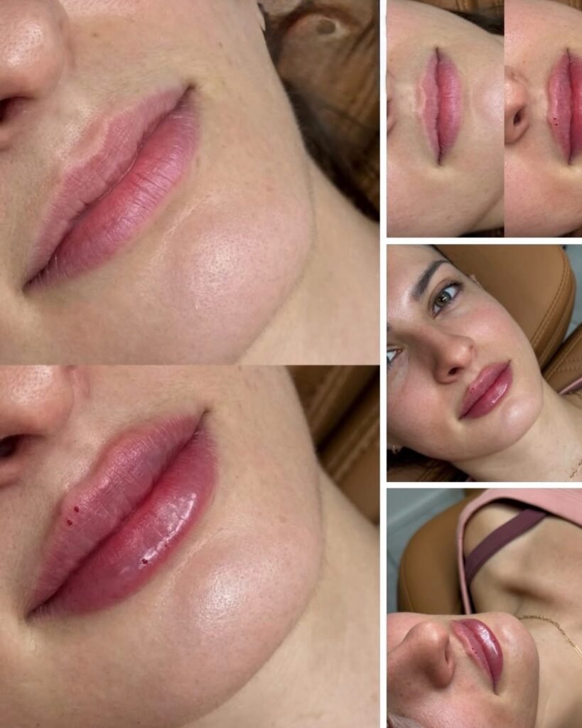 Soft lip volume and defined shape at SKN MD